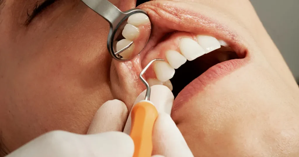 Effective Dental Care for Seniors: Gentle Oral Hygiene Routines for Sensitive Teeth and Healthy Smiles